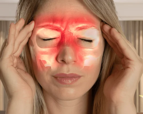 Sinusitis